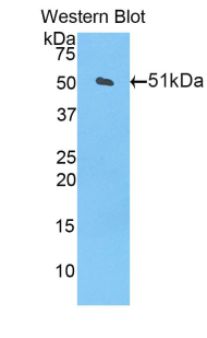 Polyclonal Antibody to Carnitine Palmitoyltransferase 1A, Liver (CPT1A)