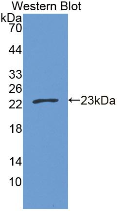 Polyclonal Antibody to Carnitine Palmitoyltransferase 1B, Muscle (CPT1B)