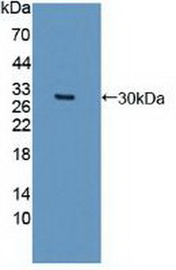 Polyclonal Antibody to Doublecortin Like Kinase 1 (DCLK1)