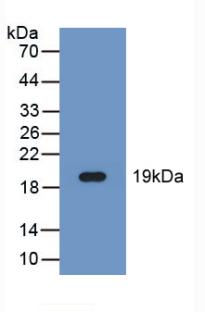 Polyclonal Antibody to Fatty Acid Desaturase 2 (FADS2)