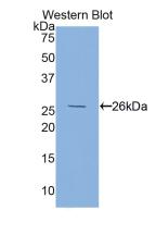 Polyclonal Antibody to Folate Receptor 1, Adult (FOLR1)