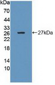 Polyclonal Antibody to Growth Factor Receptor Bound Protein 10 (Grb10)