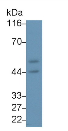 Polyclonal Antibody to Inositol Hexaphosphate Kinase 2 (IHPK2)