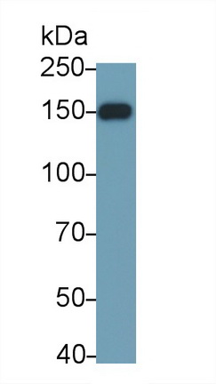 Polyclonal Antibody to Janus Kinase 2 (JAK2)