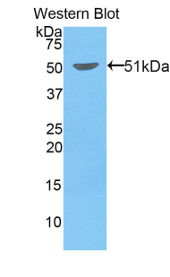 Polyclonal Antibody to Kinesin Family, Member 5A (KIF5A)