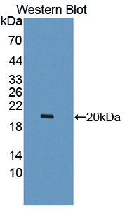 Polyclonal Antibody to Leukocyte Cell Derived Chemotaxin 2 (LECT2)