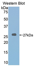 Polyclonal Antibody to Lysyl Oxidase Like Protein 2 (LOXL2)