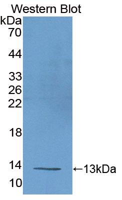 Polyclonal Antibody to Uncoupling Protein 1, Mitochondrial (UCP1)