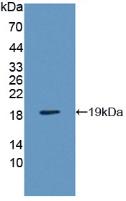 Polyclonal Antibody to Vesicle Associated Membrane Protein Associated Protein B (VAPB)