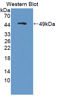 Polyclonal Antibody to Metastasis Associated Protein 2 (MTA2)