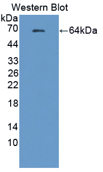 Polyclonal Antibody to Peptidyl Arginine Deiminase Type II (PADI2)