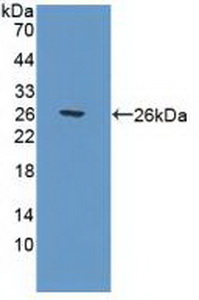 Polyclonal Antibody to Polymerase DNA Directed Gamma 1 (POLg1)