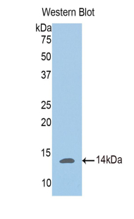 Polyclonal Antibody to Phosphoglucomutase 5 (PGM5)