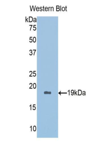 Polyclonal Antibody to Peroxiredoxin 5 (PRDX5)