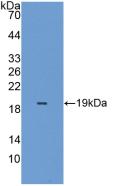 Polyclonal Antibody to Peroxiredoxin 5 (PRDX5)