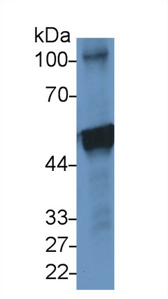 Polyclonal Antibody to Peroxiredoxin 5 (PRDX5)