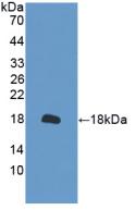 Polyclonal Antibody to Peroxiredoxin 2 (PRDX2)