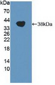 Polyclonal Antibody to Transient Receptor Potential Cation Channel Subfamily A, Member 1 (TRPA1)