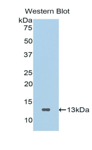 Polyclonal Antibody to Secreted Frizzled Related Protein 4 (SFRP4)