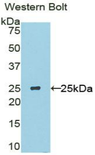 Polyclonal Antibody to Sclerostin Domain Containing Protein 1 (SOSTDC1)