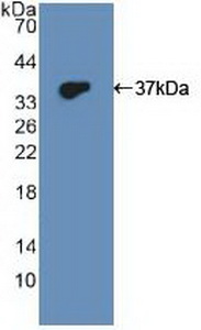 Polyclonal Antibody to Dual Specificity Phosphatase 6 (DUSP6)