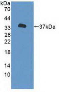 Polyclonal Antibody to Purinergic Receptor P2X, Ligand Gated Ion Channel 7 (P2RX7)