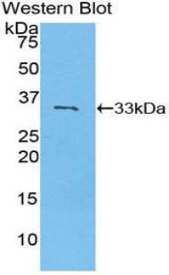 Polyclonal Antibody to Purinergic Receptor P2Y, G Protein Coupled 14 (P2RY14)