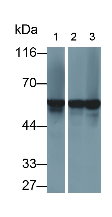 Polyclonal Antibody to Phenylalanyl tRNA Synthetase Alpha (FARSa)