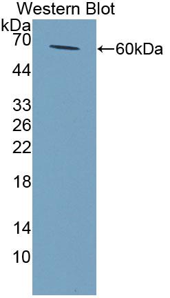 Polyclonal Antibody to N-Acetyltransferase 2 (NAT2)