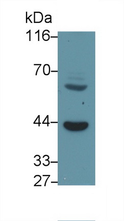 Polyclonal Antibody to Forkhead Box Protein F1 (FOXF1)