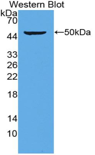 Polyclonal Antibody to Proteasome 26S Subunit, ATPase 6 (PSMC6)