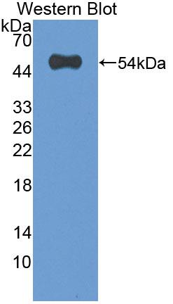 Polyclonal Antibody to Nephroblastoma Overexpressed Gene (NOV)