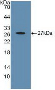 Polyclonal Antibody to Cysteine Rich Protein, Angiogenic Inducer 61 (CYR61)