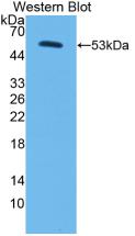 Polyclonal Antibody to Corin (CRN)