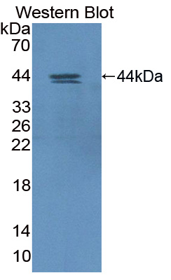 Polyclonal Antibody to Hypoxia Inducible Factor 1 Alpha Subunit Inhibitor (HIF1aN)