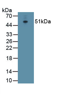 Polyclonal Antibody to ATPase, Na+/K+ Transporting Alpha 1 Polypeptide (ATP1a1)