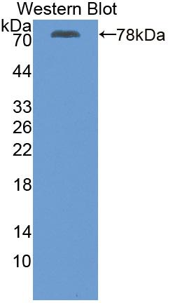 Polyclonal Antibody to ATPase, Ca++ Transporting, Cardiac Muscle, Slow Twitch 2 (ATP2A2)