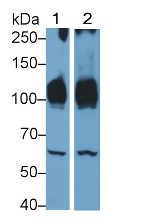 Polyclonal Antibody to ATPase, Ca++ Transporting, Cardiac Muscle, Slow Twitch 2 (ATP2A2)