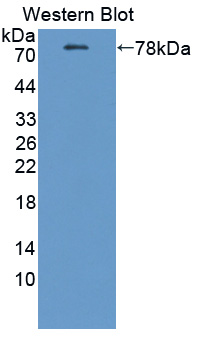 Polyclonal Antibody to ATPase, Ca++ Transporting, Plasma Membrane 2 (ATP2B2)