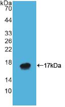Polyclonal Antibody to ATPase, H+/K+ Exchanging Alpha Polypeptide (ATP4a)