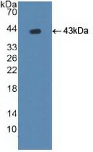 Polyclonal Antibody to ATPase, Cu++ Transporting Beta Polypeptide (ATP7b)