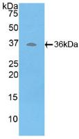 Polyclonal Antibody to ATPase, H+ Transporting, Lysosomal Accessory Protein 2 (ATP6AP2)