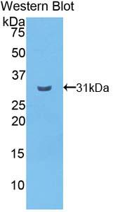 Polyclonal Antibody to Cadherin EGF LAG Seven Pass G-Type Receptor 2 (CELSR2)