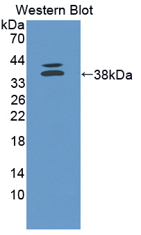 Polyclonal Antibody to Cadherin EGF LAG Seven Pass G-Type Receptor 2 (CELSR2)