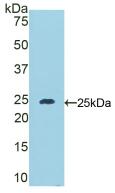 Polyclonal Antibody to Desmocollin 1 (DSC1)