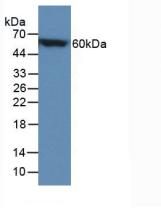 Polyclonal Antibody to Calbindin (CALB)