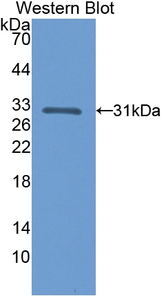 Polyclonal Antibody to Calbindin (CALB)