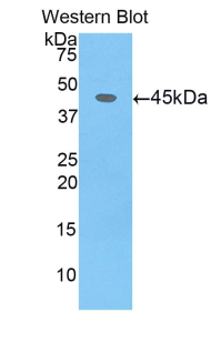 Polyclonal Antibody to Cerebral Dopamine Neurotrophic Factor (CDNF)