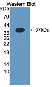 Polyclonal Antibody to Betaine Homocysteine Methyltransferase (BHMT)