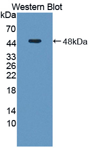 Polyclonal Antibody to Adenosylhomocysteinase (AHCY)